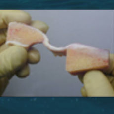 Bandersatz / lange Wadenbein-Sehne - CenoBiologics - Gelenkband / Sehne des Musculus grazilis / Sehne des Semitendunosus