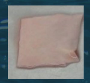 Herzchirurgie-Matrix - CenoBiologics - allograft