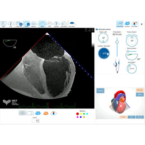 Test-Software - eTEEmothy - Medical Simulation Technologies - Ausbildung / für medizinische Simulation / medizinisch