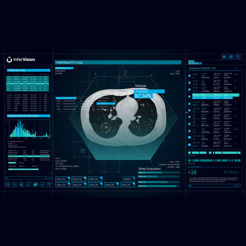 Analysesoftware - Beijing Infervision Technology Co. Ltd. - Reporting / Umform / Bestätigung