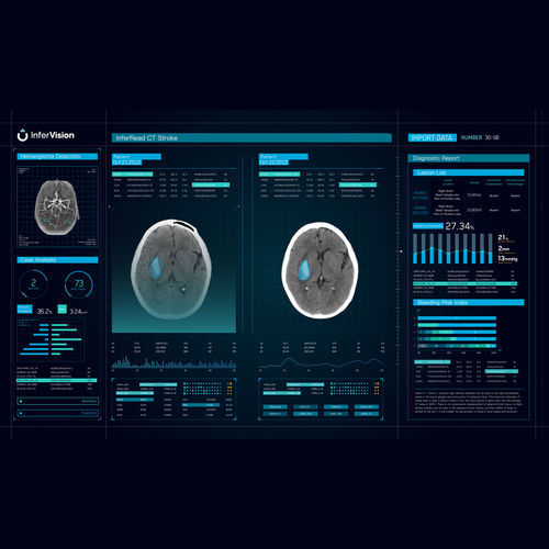Software für die Alarm-Verwaltung - CT Stroke - Beijing Infervision Technology Co. Ltd. - Umform / zur Variantenbestimmung / medizinisch