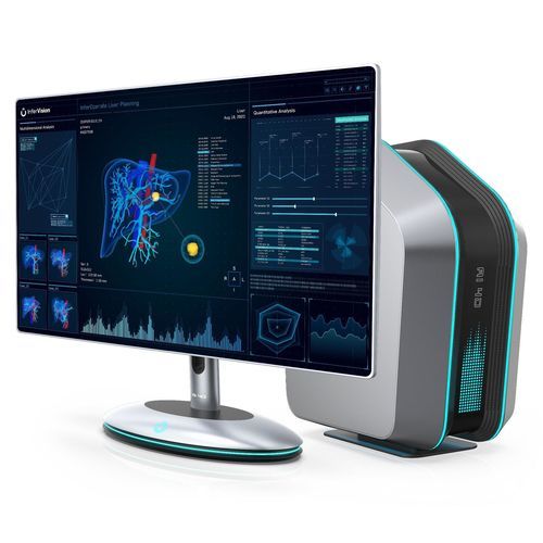 Medizinische Software - InferOperate® Suite  - Beijing Infervision Technology Co. Ltd. - OP / für Kliniken / Visualisierung