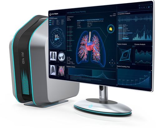 Medizinische Software - InferOperate® - Beijing Infervision Technology Co. Ltd. - für Chirurgie / OP / für Kliniken