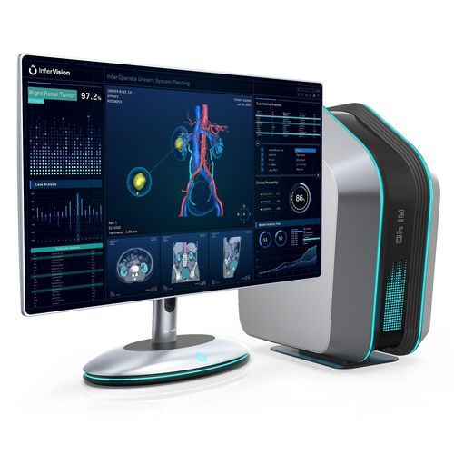 Präoperative Software - InferOperate® Suite - Beijing Infervision Technology Co. Ltd. - Urologie / für Chirurgie / Kantendetektion