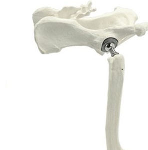 Zementierte tierärztliche Hüftprothese - THR - Anhui Bailu Small Animal Orthopedic Instrument - für Hüften-Gesamtarthroplastie