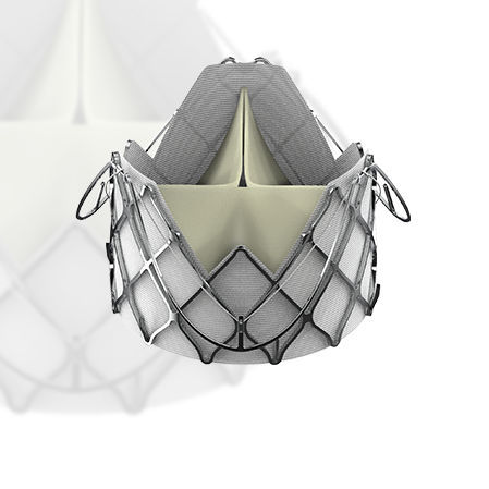 Biologischer Aortenklappenersatz / Aorta - J-Valve™ - Suzhou Jiecheng Medical Technology - aus Schweinegewebe / Nitinol / nahtlos