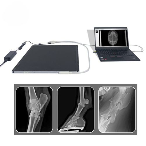 Flachbilddetektor für multifunktionale Röntgenaufnahmen - FTLFPD-V1717X - Fatali Medical - tragbar / 17 x 17