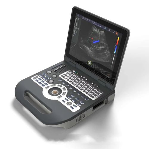 Tragbares Ultraschallgerät - FTL-UTS1600 - Fatali Medical - für Ultraschalldiagnostik in Gynäkologie und Geburtshilfe / für bildgebende Ultraschalldiagnostik im Bauch- und Beckenbereich / Farbdoppler