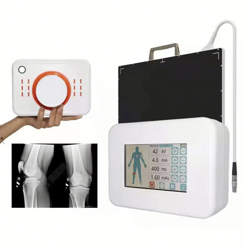 Digitales Röntgensystem - FTLF360 - Fatali Medical - für multifunktionale Röntgenaufnahmen / tragbar
