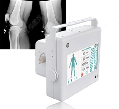Röntgengenerator für multifunktionale Röntgenaufnahmen - FTLF10 - Fatali Medical - tragbar / mit Bedienfeld / mit Batterie