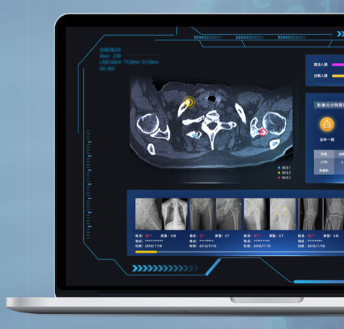 PACS mit Cloud Computing - NovaCloud® - Huiying Medical Technology (Beijing) Co., Ltd. - medizinisch