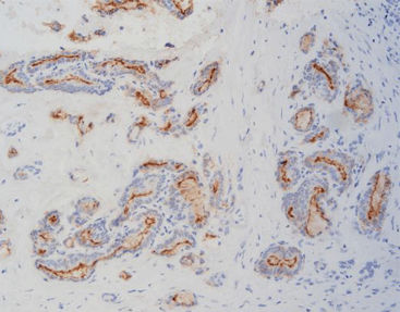 Reagenz / als Lösung - FHM0010 - Celnovte Biotechnology Co., Ltd. - Immunohistochimie / Tumormarker / aus Mäusen gewonnen