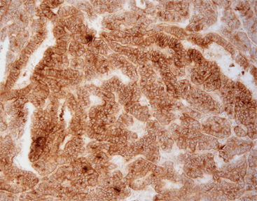 Antikörper - FGM0011 - Celnovte Biotechnology Co., Ltd. - für Krebserkrankungen / tierische Herkunft