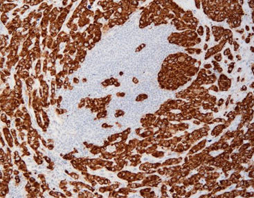 Zytokin Reagenz - FCM0180 - Celnovte Biotechnology Co., Ltd. - für Krebserkrankungen
