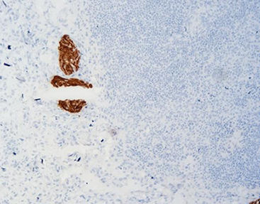 Zytokin Reagenz - FCM0140 - Celnovte Biotechnology Co., Ltd. - Gewebe / für Krebserkrankungen / aus Mäusen gewonnen