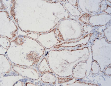 Gewebe-Reagenz - FCM0080 - Celnovte Biotechnology Co., Ltd. - Immunohistochimie / Glycoproteine