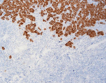 Antikörper - FCM0200 - Celnovte Biotechnology Co., Ltd. - Immunohistochimie / Protein / aus Mäusen gewonnen