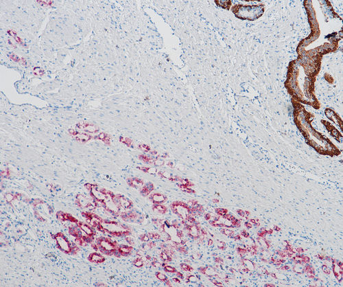 Färbelösungs-Reagenzkit - SD8009 - Celnovte Biotechnology Co., Ltd. - Gewebe / für Krebserkrankungen / Immunohistochimie