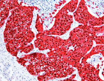 Färbelösungs-Reagenzkit - SD8001 - Celnovte Biotechnology Co., Ltd. - Immunohistochimie / alkalische Phosphatase / chromogen