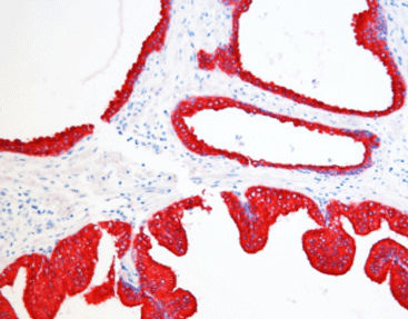 Farbstoff Reagenzkit - SD8006 - Celnovte Biotechnology Co., Ltd. - Gewebe / Immunohistochimie / alkalische Phosphatase
