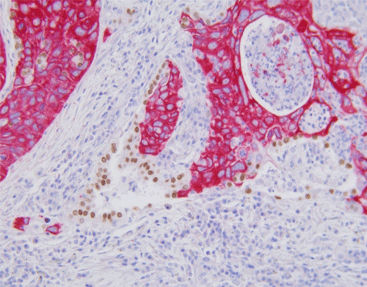 Färbelösungs-Reagenzkit - SD8103 - Celnovte Biotechnology Co., Ltd. - Gewebe / Immunohistochimie