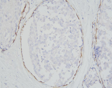 Färbelösungs-Reagenzkit - SD8105 - Celnovte Biotechnology Co., Ltd. - Gewebe / Immunohistochimie