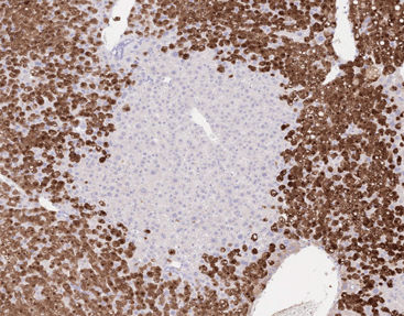 FärbelösungsReagenzkit MicroStacker™ Celnovte Biotechnology Co