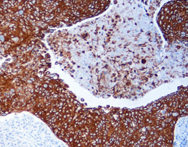 Farbstoff Reagenzkit - MicroStacker™  - Celnovte Biotechnology Co., Ltd. - Färbelösung / Enzyme / Antikörper