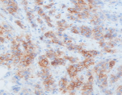 Farbstoff Reagenzkit - MicroStacker™  - Celnovte Biotechnology Co., Ltd. - Färbelösung / Enzyme / Antikörper