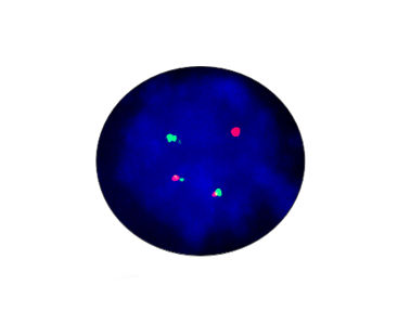 EML4-ALK-Fusionsgen-Testkit - CF1012 - Celnovte Biotechnology Co., Ltd. - für Typhus / für Forschungszwecke / Lungenkrebs