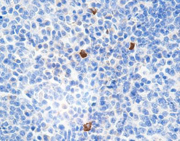 G4-Immunoglobuline-Reagenz - CIR-0131 - Celnovte Biotechnology Co., Ltd. - Färbelösung / monoklonaler Antikörper / polyklonaler Antikörper