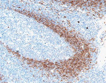 Färbelösungs-Reagenz - CIR-0111 - Celnovte Biotechnology Co., Ltd. - Antikörper / Farbstoff / für Zytologie