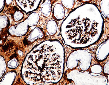 Färbelösungs-Reagenzkit - Celnovte Biotechnology Co., Ltd. - Diagnose / für die Histologie / flüssig