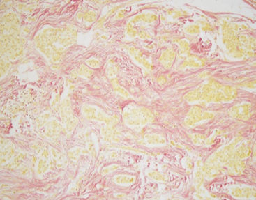 Färbelösungs-Reagenzkit - Van Gieson - Celnovte Biotechnology Co., Ltd. - für die Histologie
