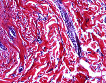 Farbstoff Reagenzkit - Celnovte Biotechnology Co., Ltd. - Collagenbeschichtung / für die Histologie