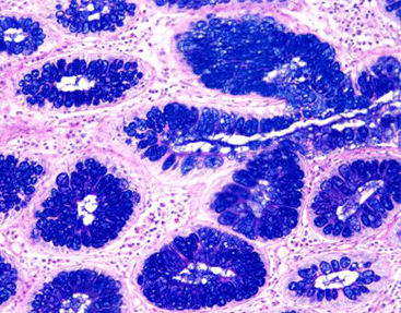 Farbstoff Reagenzkit - AB-PAS  - Celnovte Biotechnology Co., Ltd. - für die Histologie