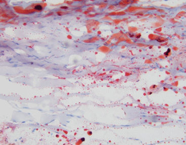 Farbstoff Reagenzkit - Celnovte Biotechnology Co., Ltd. - für die Histologie / Lipid