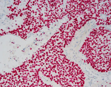 Farbstoff Reagenz - SD8003 - Celnovte Biotechnology Co., Ltd. - Gewebe / Immunohistochimie / alkalische Phosphatase