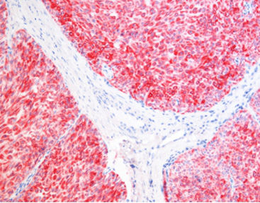 Färbelösungs-Reagenz - SD8007 - Celnovte Biotechnology Co., Ltd. - Gewebe / Immunohistochimie / alkalische Phosphatase