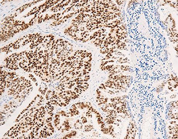 Monoklonaler Antikörper - CEM-0081 - Celnovte Biotechnology Co., Ltd. - polyklonaler Antikörper / für Forschungszwecke / Gewebe