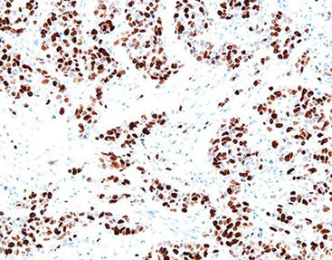 Monoklonaler Antikörper - Ki-67 - Celnovte Biotechnology Co., Ltd. - polyklonaler Antikörper / für Forschungszwecke / Gewebe