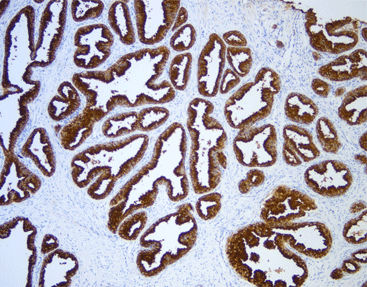 Monoklonaler Antikörper - CPM-0404 - Celnovte Biotechnology Co., Ltd. - polyklonaler Antikörper / Enzyme / Protease