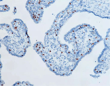 Monoklonaler Antikörper - CCM-0332 - Celnovte Biotechnology Co., Ltd. - polyklonaler Antikörper / für Forschungszwecke / Gewebe