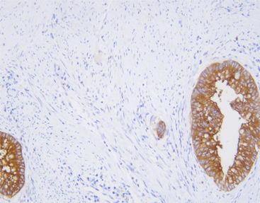 Monoklonaler Antikörper - CCM-0833 - Celnovte Biotechnology Co., Ltd. - polyklonaler Antikörper / für Forschungszwecke / Gewebe