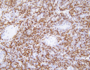 Antikörper - CBM-0042 - Celnovte Biotechnology Co., Ltd. - Zytogenetisch / Apoptose