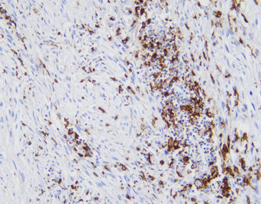 Antikörper - CCM-0702 - Celnovte Biotechnology Co., Ltd. - Gewebe / Immunohistochimie / Tumormarker