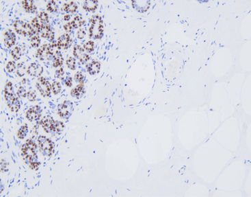 Antikörper - CSM-0181 - Celnovte Biotechnology Co., Ltd. - für Kliniken / Immunohistochimie / für Krebserkrankungen
