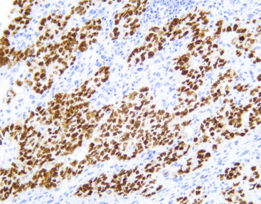 Antikörper - CSM-0131 - Celnovte Biotechnology Co., Ltd. - für Kliniken / Immunohistochimie / Protein