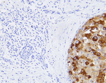 Monoklonaler Antikörper - CMM-0112 - Celnovte Biotechnology Co., Ltd. - polyklonaler Antikörper / für Forschungszwecke / Gewebe