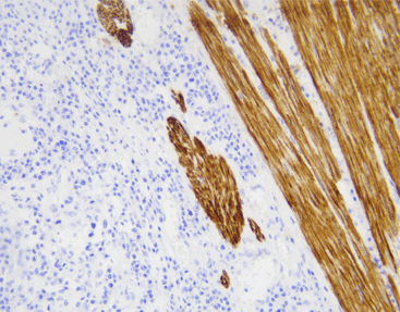 Antikörper - CDM-0023 - Celnovte Biotechnology Co., Ltd. - für Kliniken / Immunohistochimie / Protein